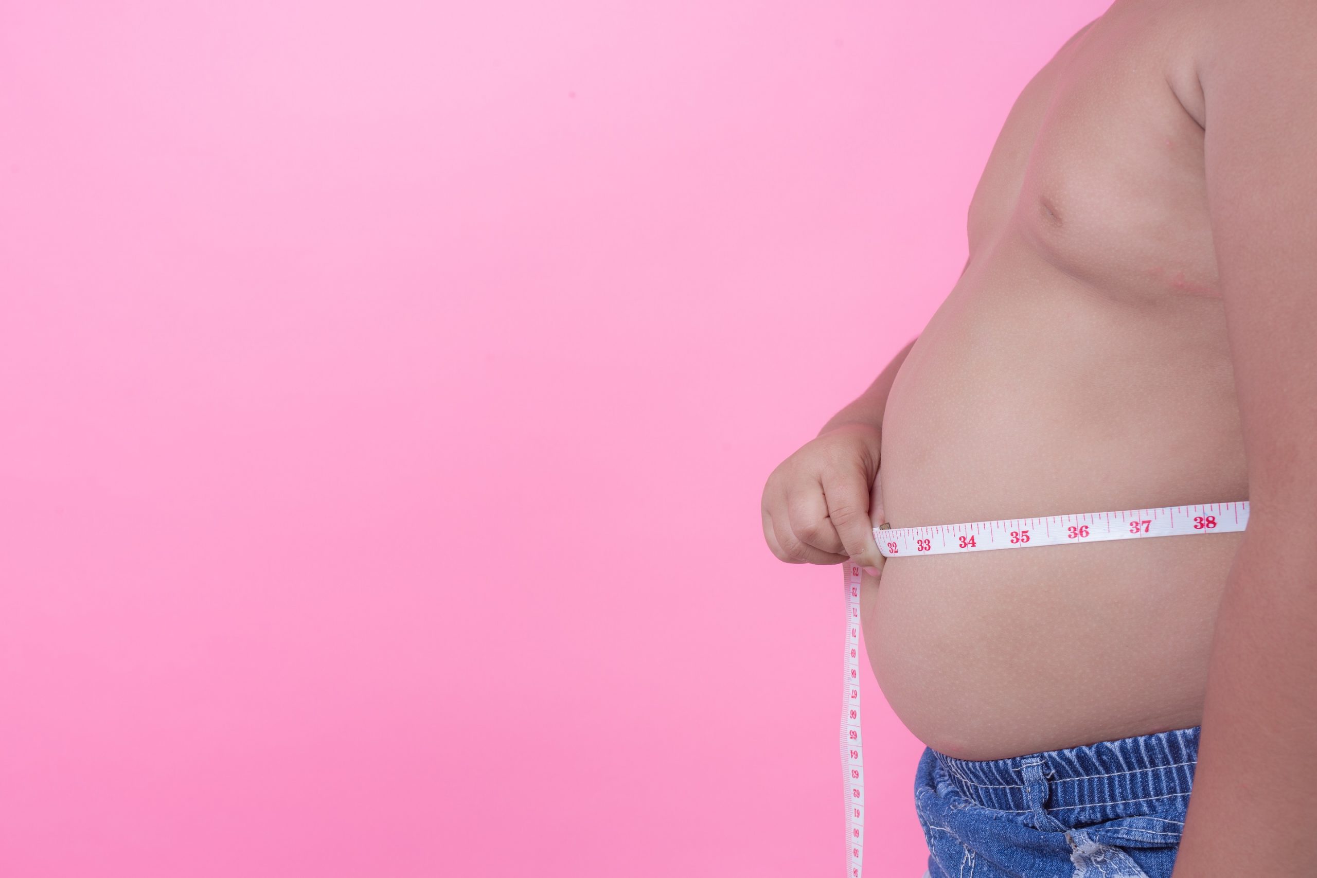 In light of obesity week, what is the current state of malnutrition and obesity in South Africa